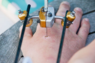Cropped image of hand with external fixation