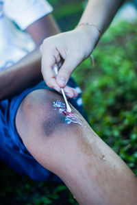 Cropped hand of doctor applying medicine on wound