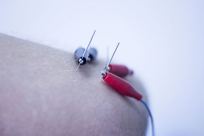 Close-up of person skin with electro acupuncture against white background
