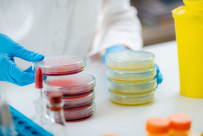 Microbiologist preparing bacterial cultures in a research laboratory, holding petri dish 