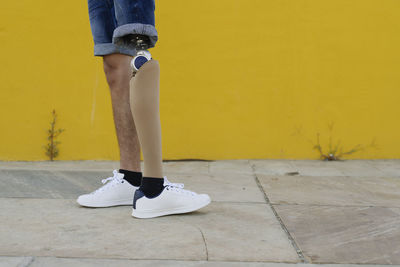 Man with leg prosthesis standing on street
