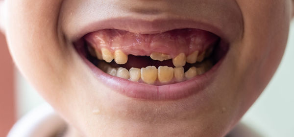 Close-up of boy with gap toothed at home
