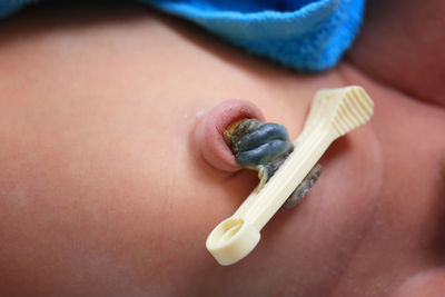 Close-up of umbilical cord on baby