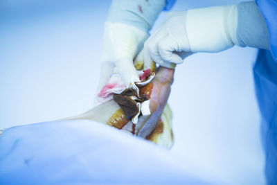 Close-up of surgeon cleaning patient wounded foot in operating room