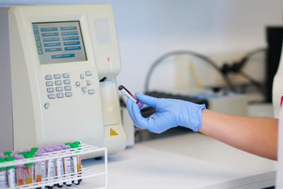 Assorted blood sample tubes on table near crop anonymous medical technologist with professional hematology equipment during diagnostic process in laboratory