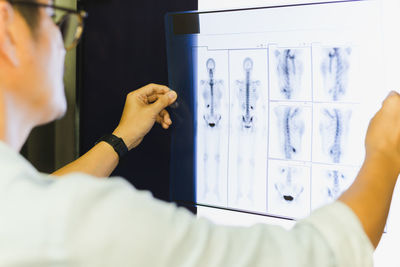 Side view of medical doctor looking at human x-ray