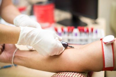 Cropped hands of doctor removing blood sample from patient arm