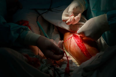 Midsection of surgeons stitching patient leg in hospital