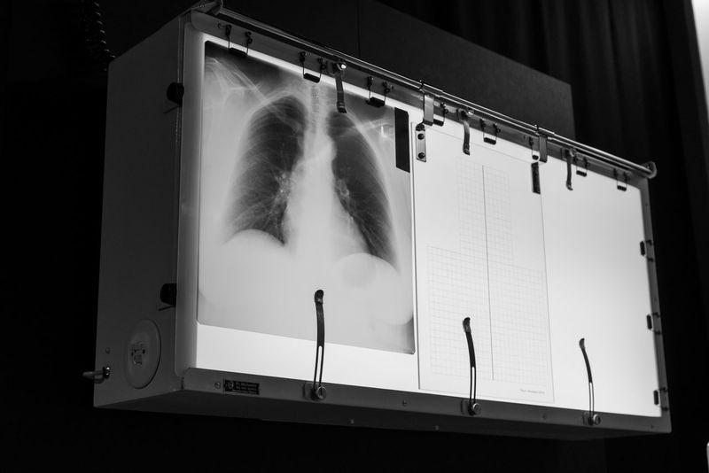 Xray pictures Curated Photography on EyeEm