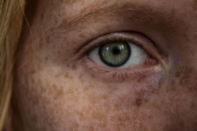 Cropped image of woman with freckles