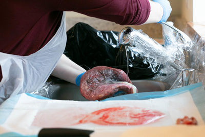 Gloved hands rinsing placenta in sink.