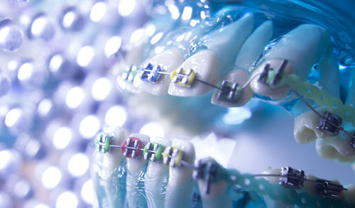 Close-up of dental equipment