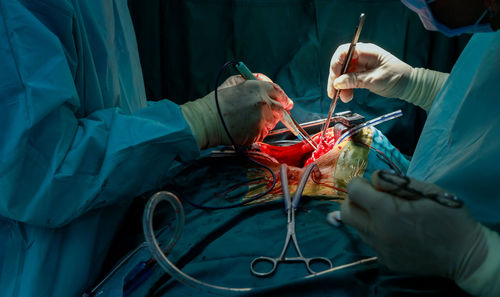 Midsection of surgeons stitching patient leg in hospital