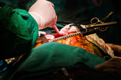 Doctors performing surgery on patient in operating room