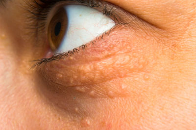 Extreme close-up of human eye