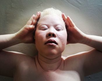 Body and face of an albinistic woman 