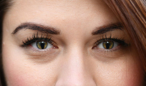 Coloboma. close-up portrait of woman