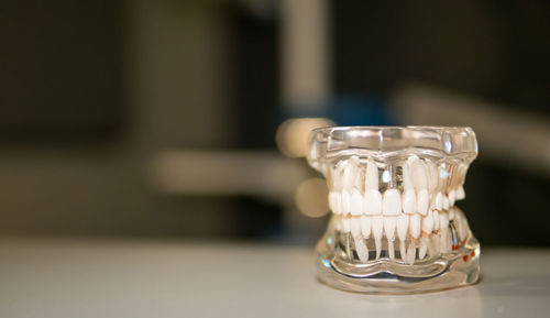 Close-up of dentures on table