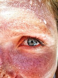 Cropped image of woman with sunburned face