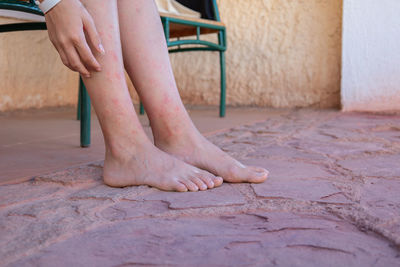 Girl's legs bitten by mosquitoes, close-up. woman scratching her feet bitten by insects.