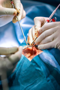 Close-up of doctors operating patient