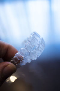 Cropped hand of woman holding dental aligner