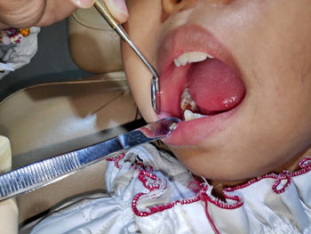 Close-up of dentist examining girl teeth