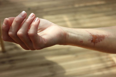 Close-up of hand with wound