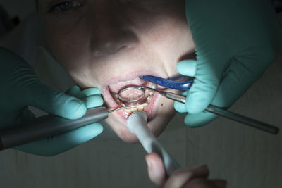Close-up of dentist treatment to patient 