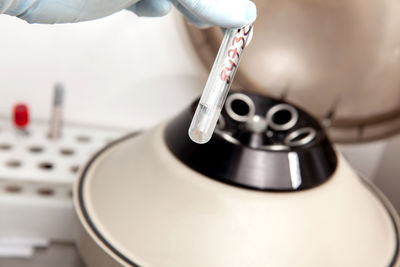 Scientist preparing a peritoneal fluid sample for cytology analysis in the laboratory. 