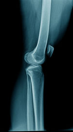 Close-up of human feet in black background
