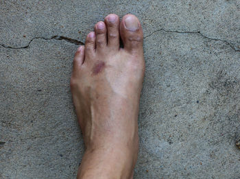 human leg