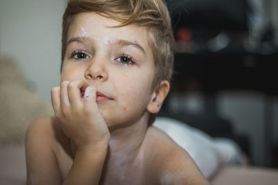 Boy infected with chickenpox 