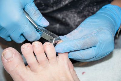 Pedicure master removes dead skin from the client's feet using medical nippers