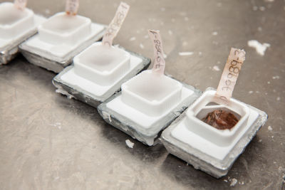 Embedded tissues in paraffin blocks for sectioning. pathology laboratory. cancer diagnosis.