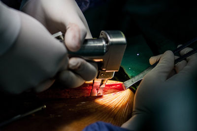 Cropped hands of doctor performing surgery on patient in hospital