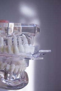 Close-up of dentures on glass table