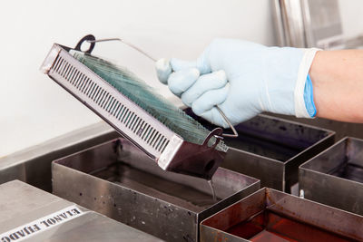 Scientist staining microscope slides for cytology studies in the laboratory. 