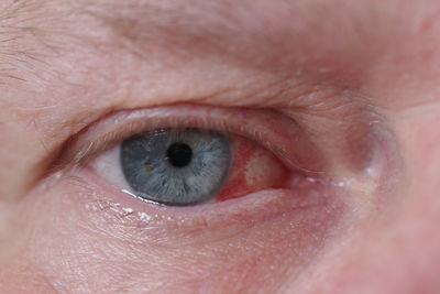 The eye of a man, a macro- star. hemorrhage. sick eye, blood vessel burst. high quality photo