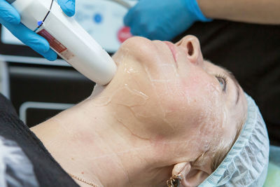Non-surgical face lifting. smas lifting ultrasonic. the process of rejuvenation. 