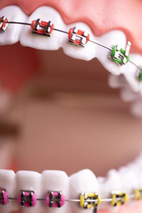 Close-up of human teeth with braces at medical clinic