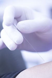 Close-up of hand holding acupuncture needle on human body par