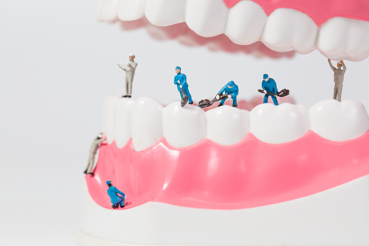 Teeth model