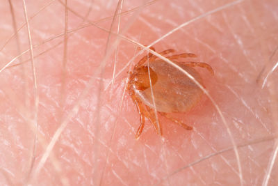 Extreme close-up of tick on human skin