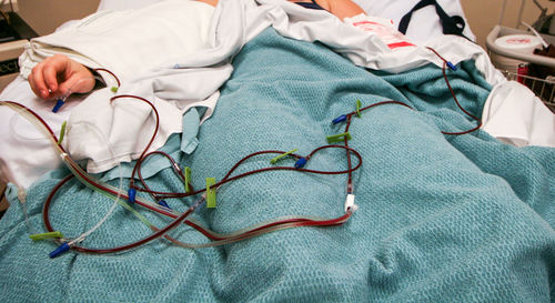 High angle view of person during bone marrow donation