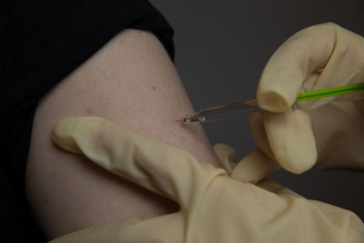 Close-up of doctor injecting syringe on patient arm