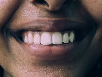 Cropped image of woman with toothy smile