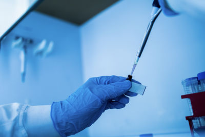 Cropped hand of person holding dental equipment