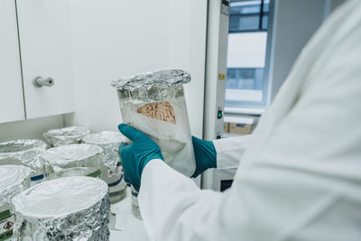 Scientist holding preserved human brain beaker while standing at laboratory