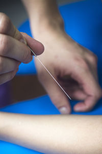 Cropped hand of doctor examining patient with acupuncture needle at hospital